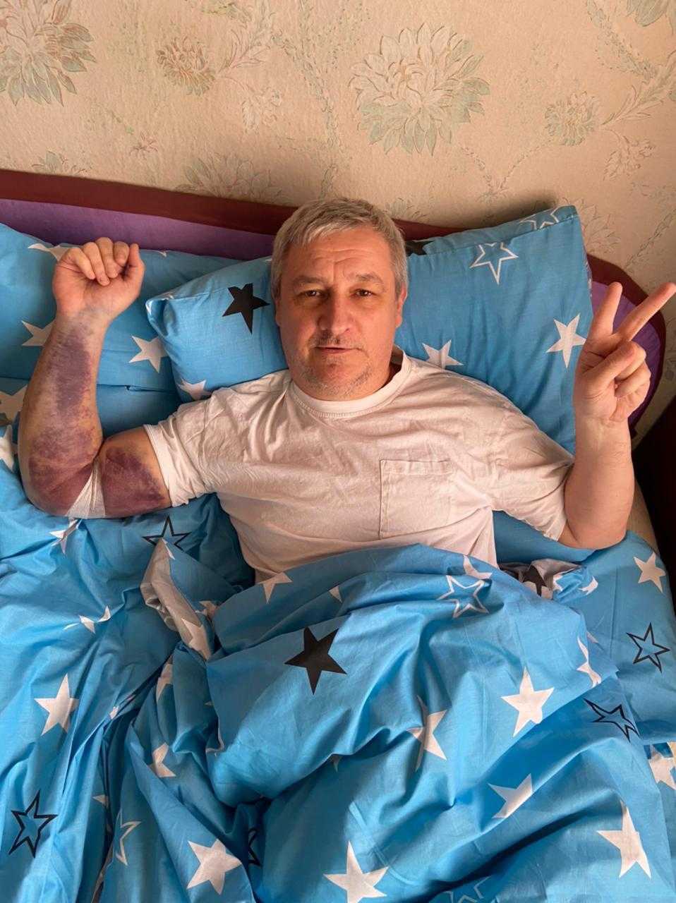 KGK Ukrayna temsilcisi savaşta yaralandı